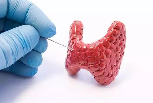 甲状腺疾病，包括甲状腺功能减退和甲状腺功能亢进，自古以来就是反复被医学研究人员研究的疾病