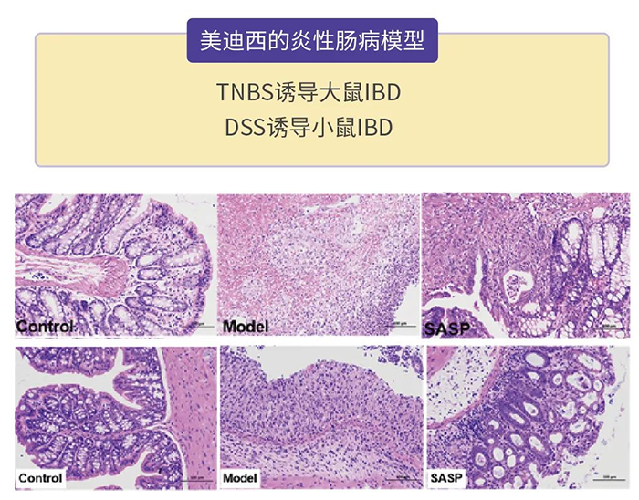 富联娱乐的炎性肠病模型.png 富联娱乐的炎性肠病模型.png